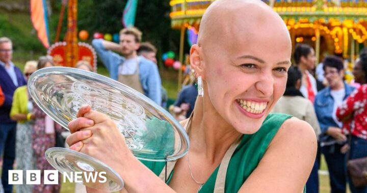 ‘Alopecia changed my perception of beauty’ says Bake Off winner